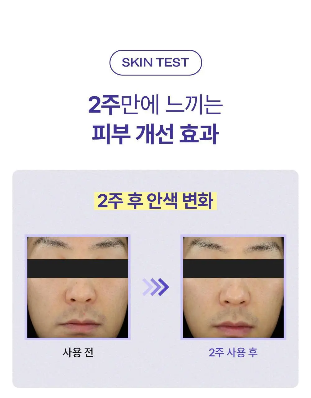 [모공케어] 무슈제이 레티놀로지 데일리 리페어 (로션/에센스) 택 1 상세페이지 23